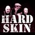 Hard Skin - The Prince Albert (Brighton)