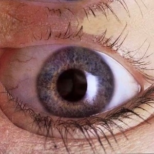 WarpVision